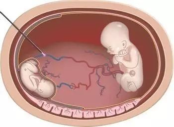 免费无码又黄又爽又刺激 但为了找更刺激的免费