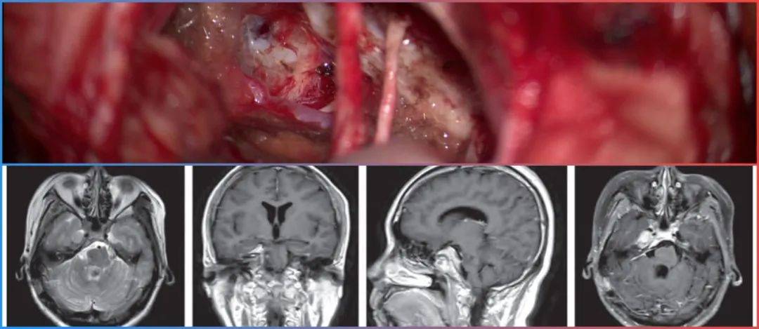 與未成年人亂倫