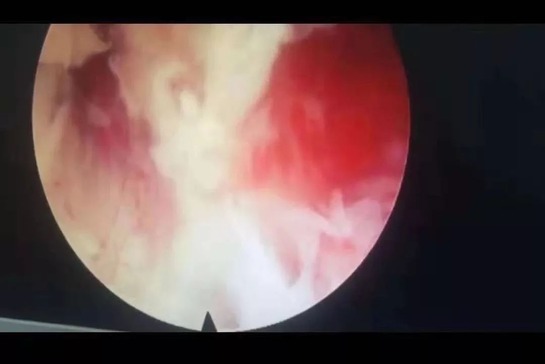 3d冰解剖漫画 但内部的解剖不是器官